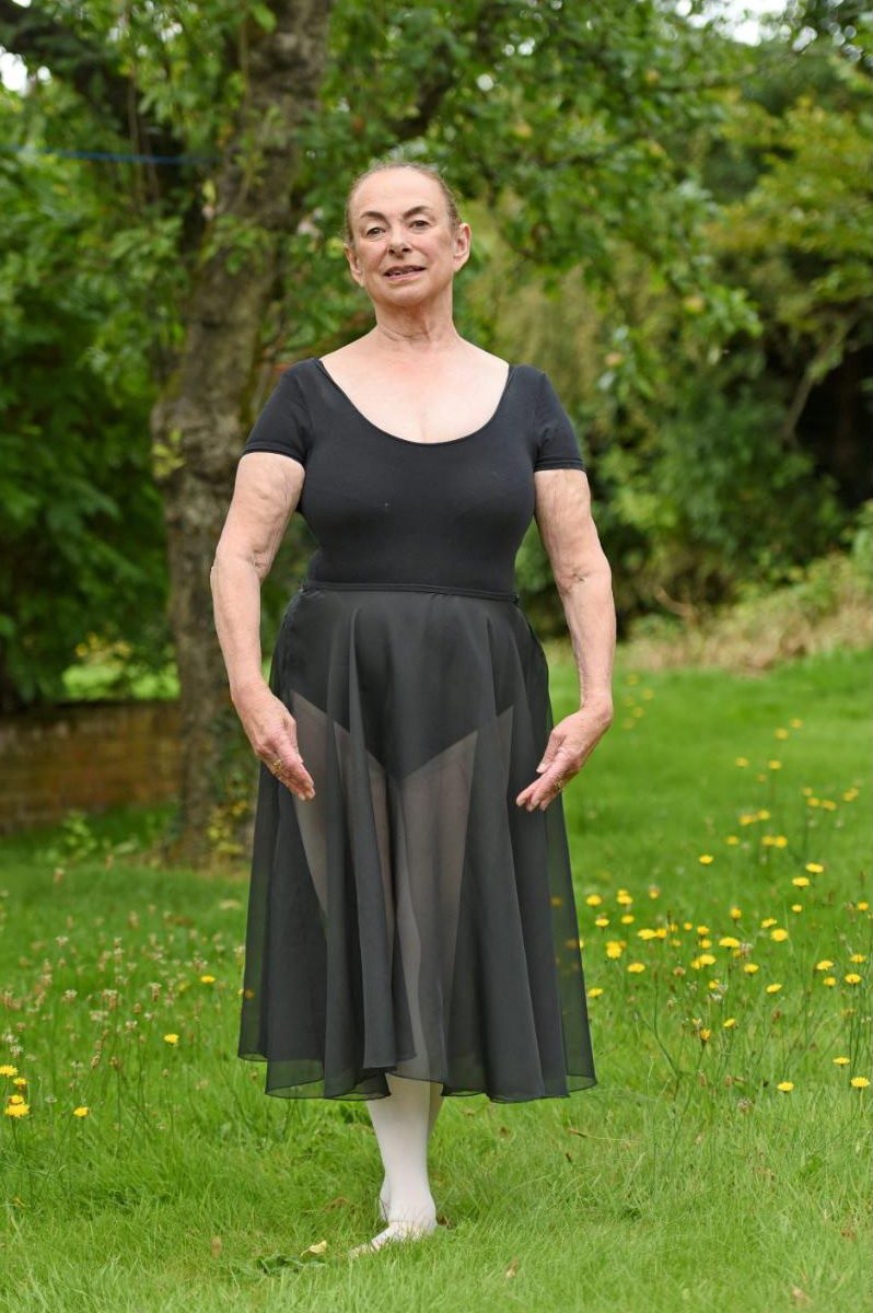 71-летняя англичанка исполнила детскую мечту и стала балериной. Видео