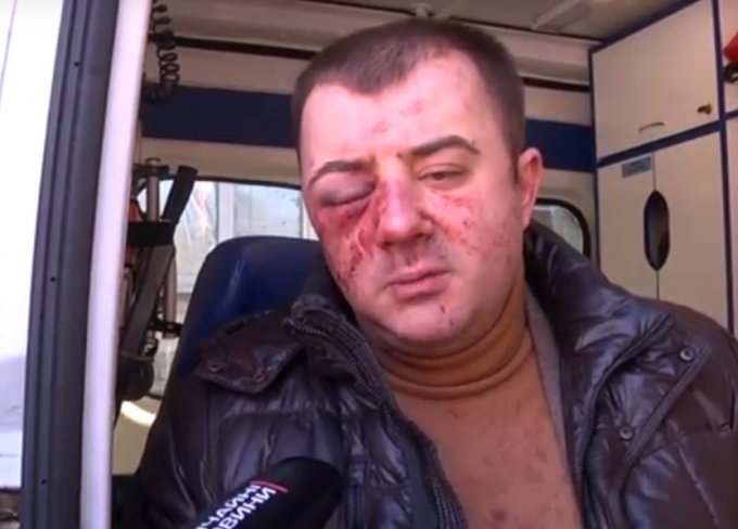 Известного адвоката зверски избили "по заказу" в Днепре. Видео