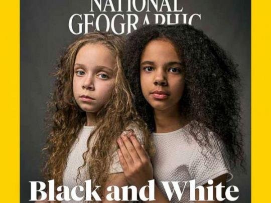 National Geographic разместила на обложке необычных близняшек. Фото