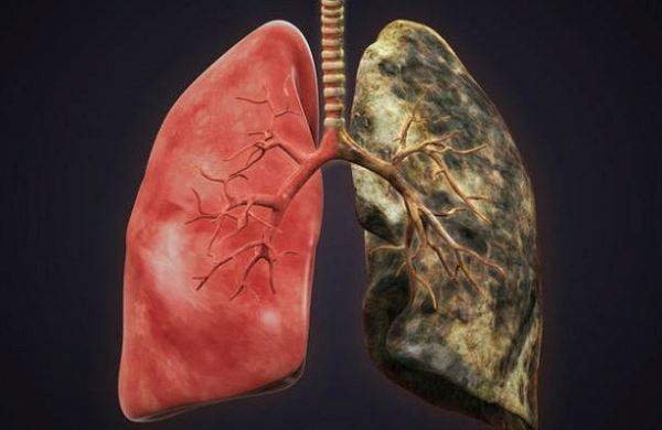 Натуральні способи підтримки функції легенів
